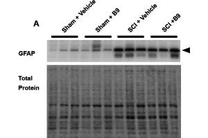 Western blot showing a band at the molecular weight corresponding to GFAP (cat.