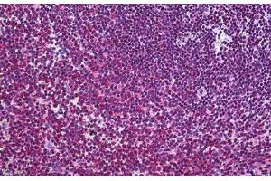 Human Spleen: Formalin-Fixed, Paraffin-Embedded (FFPE) (FLIP Antikörper  (AA 178-277))