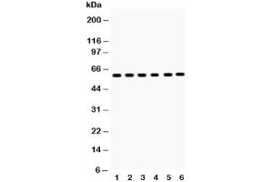 Western blot testing of EAAT2 antibody and Lane 1:  rat brain (SLC1A2 Antikörper  (AA 461-574))