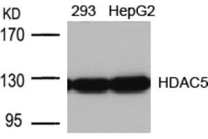 Image no. 1 for anti-Histone Deacetylase 5 (HDAC5) (AA 496-500) antibody (ABIN197340) (HDAC5 Antikörper  (AA 496-500))