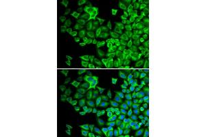 Immunofluorescence analysis of A549 cells using HCK antibody (ABIN5971109). (HCK Antikörper)