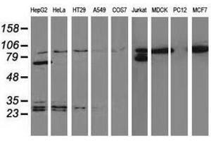 Image no. 6 for anti-Catenin (Cadherin-Associated Protein), beta 1, 88kDa (CTNNB1) antibody (ABIN1496890) (CTNNB1 Antikörper)