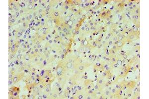 Immunohistochemistry of paraffin-embedded human liver tissue using ABIN7156608 at dilution of 1:100 (IL29 Antikörper  (AA 21-200))