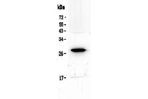 Western blot analysis of IL15RA using anti-IL15RA antibody .