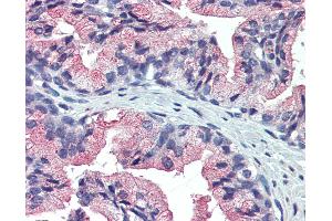 Anti-TM9SF3 antibody IHC of prostate, human. (TM9SF3 Antikörper  (Internal Region))