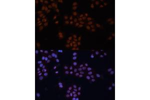 Immunofluorescence analysis of HeLa cells using GTF2I antibody (ABIN6129629, ABIN6141510, ABIN6141512 and ABIN6216068) at dilution of 1:100. (GTF2I Antikörper  (AA 600-810))