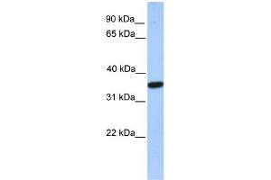 WB Suggested Anti-MOGAT1 Antibody Titration:  0. (MOGAT1 Antikörper  (C-Term))