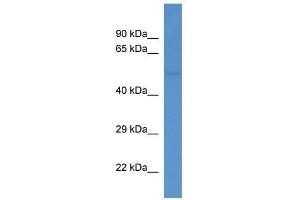 Western Blot showing Fkrp antibody used at a concentration of 1. (FKRP Antikörper  (C-Term))