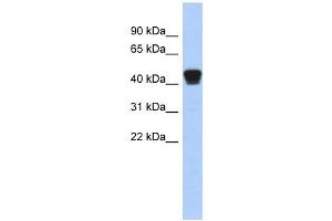 TXNDC4 antibody used at 1 ug/ml to detect target protein. (ERP44 Antikörper)