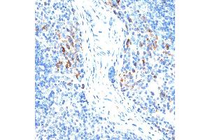 Immunohistochemistry of paraffin-embedded mouse spleen using MMP9 antibody (ABIN6131951, ABIN6143920, ABIN6143923 and ABIN6213777) at dilution of 1:100 (40x lens). (MMP 9 Antikörper  (AA 538-707))