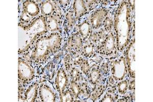 IHC analysis of MRE11 using anti-MRE11 antibody (ABIN7601056).