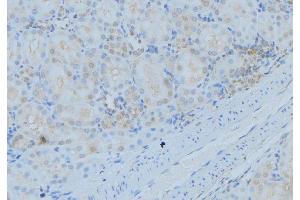 ABIN6279339 at 1/100 staining Mouse kidney tissue by IHC-P.