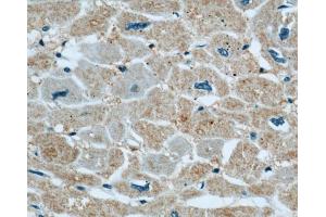 Immunohistochemistry (IHC) image for anti-Xin Actin-Binding Repeat Containing 2 (XIRP2) antibody (ABIN2906145) (XIRP2 Antikörper)