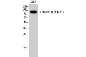 Western Blotting (WB) image for anti-Insulin Receptor (INSR) (pTyr1361) antibody (ABIN3173234) (Insulin Receptor Antikörper  (pTyr1361))