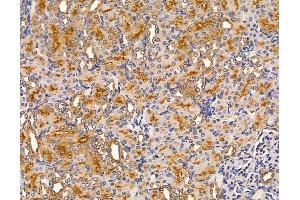 ABIN6263481 and ABIN6279564 at 1/100 staining rat kidney tissue by IHC-P.