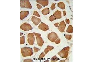 Formalin-fixed and paraffin-embedded human skeletal muscle reacted with ANGPTL4 Antibody (Center), which was peroxidase-conjugated to the secondary antibody, followed by DAB staining. (ANGPTL4 Antikörper  (AA 138-167))