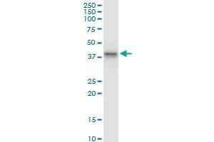 ABO monoclonal antibody (M08), clone 1B7. (ABO Antikörper  (AA 273-354))