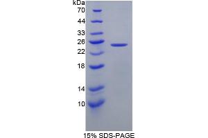Image no. 1 for Calcyphosine (CAPS) (AA 1-189) protein (His tag) (ABIN6236861)
