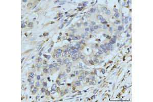 IHC analysis of GP210/NUP210 using anti-GP210/NUP210 antibody (ABIN7600707). (NUP210 Antikörper  (AA 221-1724))