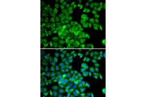 Immunofluorescence analysis of U2OS cells using TCP1 antibody. (TCP1 alpha/CCTA Antikörper  (AA 307-556))