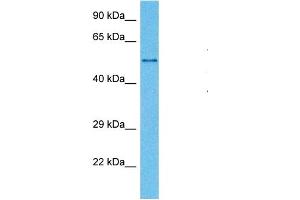 Host:  Mouse  Target Name:  MAOB  Sample Tissue:  Mouse Testis  Antibody Dilution:  1ug/ml (Monoamine Oxidase B Antikörper  (N-Term))