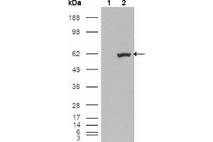 Western blot analysis using ETV1 mouse mAb against HEK293T cells transfected with the pCMV6-ENTRY control (1) and pCMV6-ENTRY ETV1 cDNA (2). (ETV1 Antikörper)