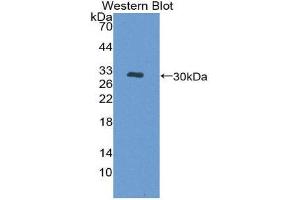 Western Blotting (WB) image for anti-Protein Kinase D1 (PRKD1) (AA 651-876) antibody (ABIN2119727)