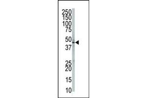 Image no. 2 for anti-GPI-anchor transamidase (GPI8) (N-Term) antibody (ABIN357725) (PIGK Antikörper  (N-Term))