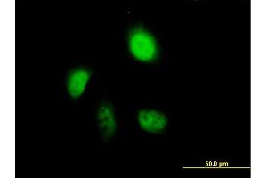 Immunofluorescence of purified MaxPab antibody to ANXA7 on HeLa cell. (Annexin VII Antikörper  (AA 1-466))