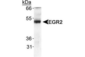 Western blot analysis of EGR2 in human fetal lung tissue using EGR2 polyclonal antibody . (EGR2 Antikörper  (AA 200-300))