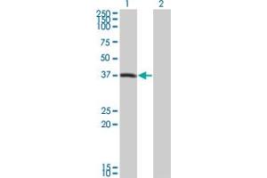 Western Blot analysis of PEX10 expression in transfected 293T cell line by PEX10 monoclonal antibody (M01), clone 1B8. (PEX10 Antikörper  (AA 1-326))