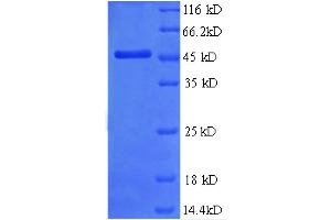 SDS-PAGE (SDS) image for Metalloproteinase Inhibitor 2 (TIMP2) (AA 30-220), (partial) protein (GST tag) (ABIN5712524)
