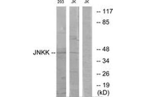 Western blot analysis of extracts from 293/Jurkat cells, using JNKK Antibody. (MAP2K4 Antikörper  (AA 316-365))