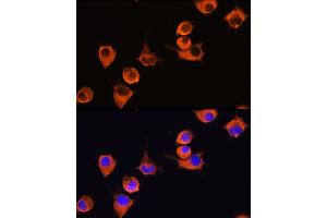 Immunofluorescence analysis of L929 cells using MFI2 Rabbit pAb (ABIN6131379, ABIN6143795, ABIN6143796 and ABIN6222350) at dilution of 1:100 (40x lens). (MFI2 Antikörper  (AA 20-200))