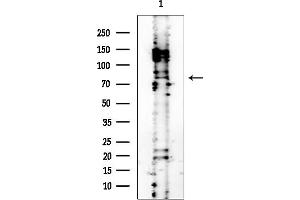 Western blot analysis of lysates from PC12 cells, using PFKP Mouse Monoclonal Antibody at 1/1000 dilution.