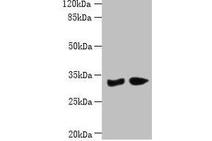 Western blot All lanes: PBLD antibody at 6 μg/mL Lane 1: Mouse liver tissue Lane 2: Mouse kidney tissue Secondary Goat polyclonal to rabbit IgG at 1/10000 dilution Predicted band size: 32 kDa Observed band size: 32 kDa