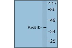 Image no. 1 for anti-RAD51 Homolog D (RAD51D) antibody (ABIN317685) (RAD51D Antikörper)