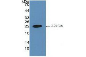 Detection of Recombinant CYFRA21-1, Human using Polyclonal Antibody to Cytokeratin Fragment Antigen 21-1 (CYFRA21-1)