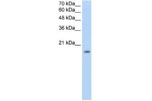 ZNF580 antibody used at 0. (ZNF580 Antikörper  (N-Term))