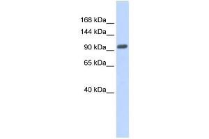 Western Blotting (WB) image for anti-Zinc Finger Protein 512B (ZNF512B) antibody (ABIN2458007) (ZNF512B Antikörper)