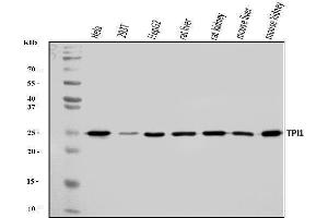 Western blot analysis of TPI1 using anti-TPI1 antibody (ABIN7599216).