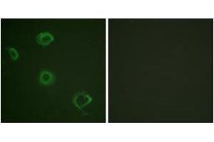 Immunofluorescence analysis of A549 cells, using Interferon-gamma Receptor alpha (Phospho-Tyr457) Antibody. (IFNGR1 Antikörper  (pTyr457))