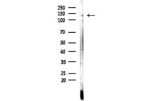 anti-Janus Kinase 1 (JAK1) (pTyr1022), (pTyr1023) antibody