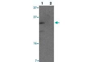 Western blot analysis of YPEL1 in HeLa cell lysate with YPEL1 polyclonal antibody  at 1 ug/mL in (lane 1) the absence and (lane 2) the presence of blocking peptide. (YPEL1 Antikörper  (N-Term))