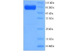 SDS-PAGE (SDS) image for Pyruvate Kinase, Liver and RBC (PKLR) (AA 1-574), (full length) protein (His tag) (ABIN5713732)