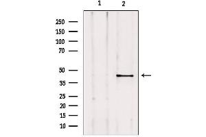 Western blot analysis of extracts from mouse lung, using AKAP5 Antibody.
