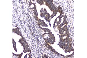 IHC analysis of CLPX using anti-CLPX antibody . (CLPX Antikörper  (AA 337-574))