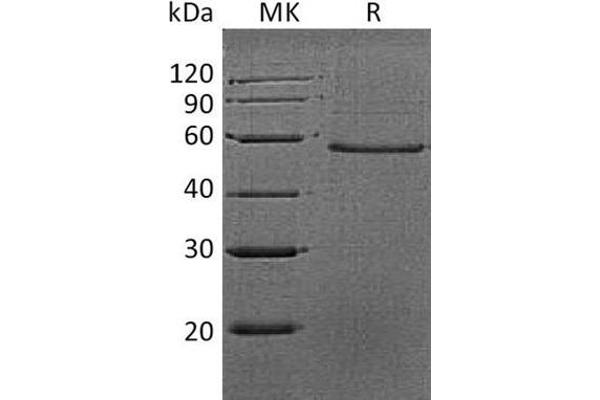 Dermatopontin Protein (DPT) (Fc Tag)