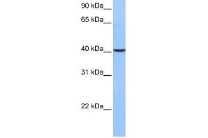 WB Suggested Anti-AGBL5 Antibody Titration: 0. (AGBL5 Antikörper  (C-Term))