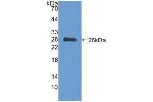 Detection of Recombinant EBI3, Human using Polyclonal Antibody to Epstein Barr Virus Induced Protein 3 (EBI3) (EBI3 Antikörper  (AA 21-229))